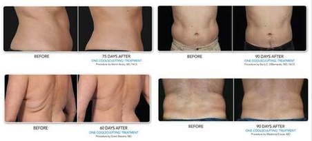 Lose Fat Photo